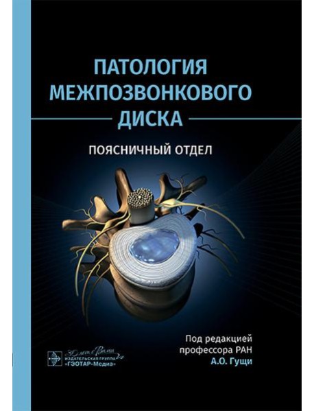 Патология межпозвонкового диска. Поясничный отдел