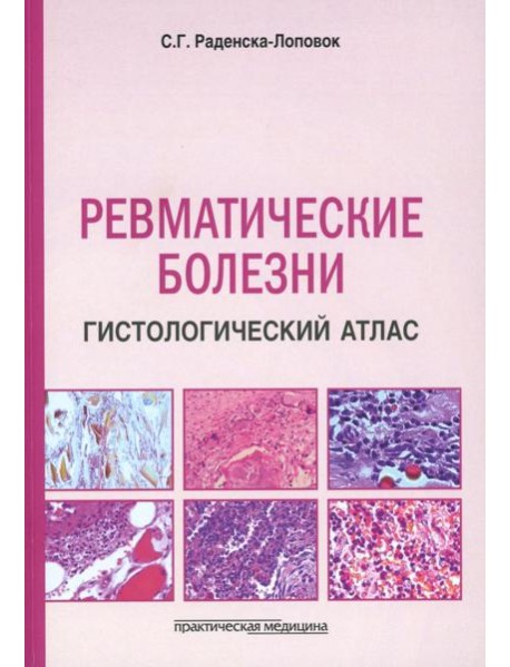 Ревматические болезни. Гистологический атлас