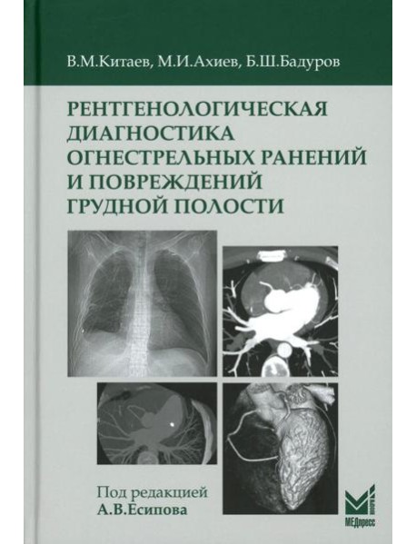 Рентгенологическая диагностика огнестрельных ранений и повреждений грудной полости