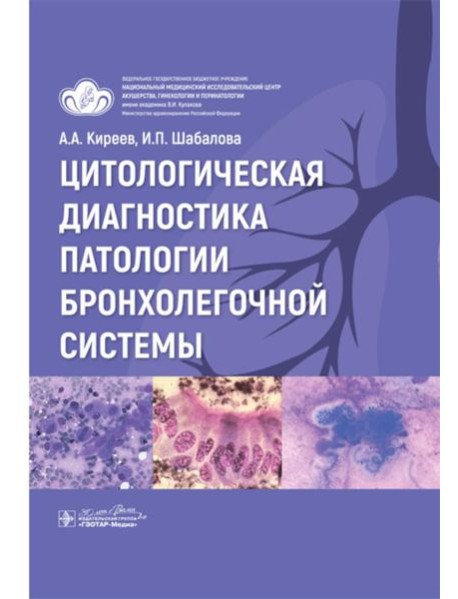 Цитологическая диагностика патологии бронхолегочной системы