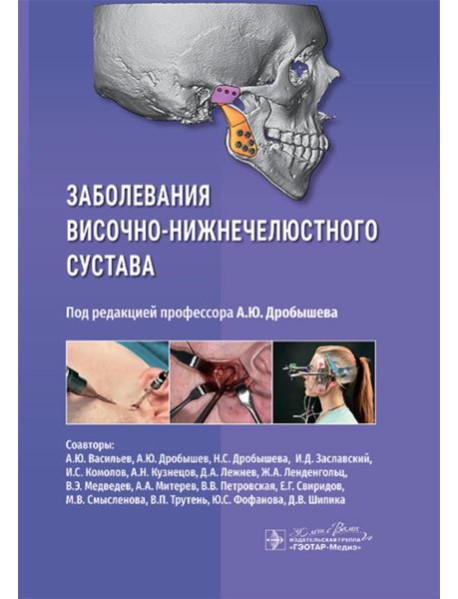 Заболевания височно-нижнечелюстного сустава