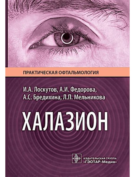 Халазион