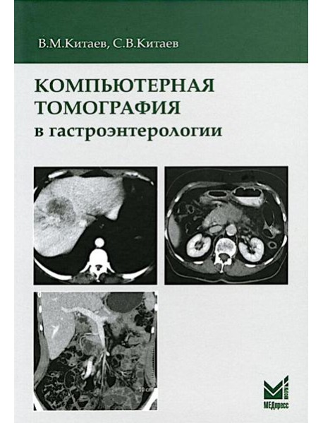 Компьютерная томография в гастроэнтерологии: руководство для врачей. 3-е изд., испр.и доп