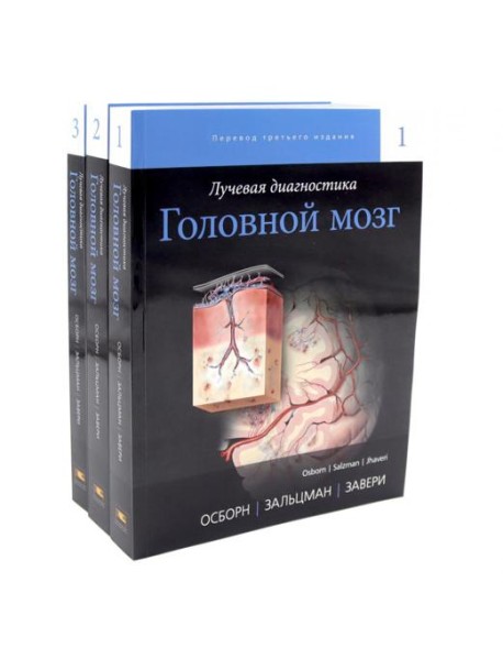 Лучевая диагностика. Головной мозг. В 3 т