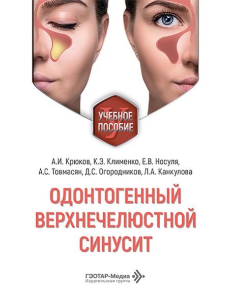 Одонтогенный верхнечелюстной синусит : учебное пособие