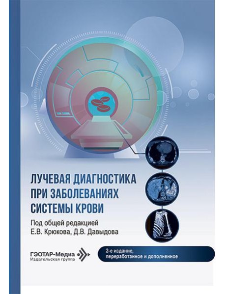 Лучевая диагностика при заболеваниях системы крови . 2-е изд., перераб. и доп