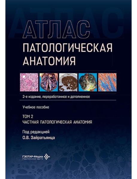 Патологическая анатомия. Атлас. В 2 т. Т. 2: Частная патологическая анатомия: Учебное пособие. 2-е изд., перераб. и доп