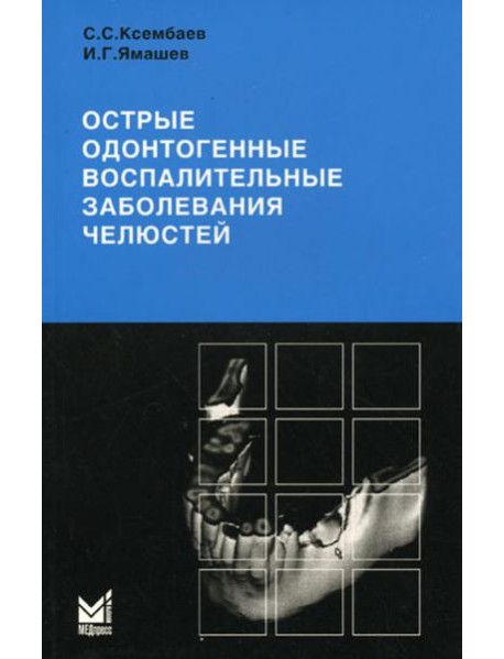 Острые одонтогенные воспалительные заболевания челюстей. Диагностика и лечение анго-и остеогенных нарушений