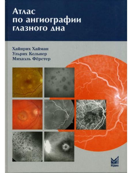 Атлас по ангиографии глазного дна
