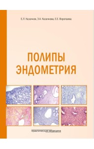 Полипы эндометрия: Учебное пособие