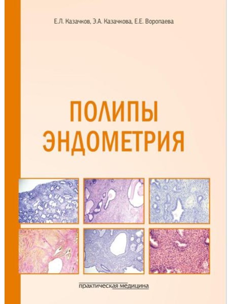 Полипы эндометрия: Учебное пособие