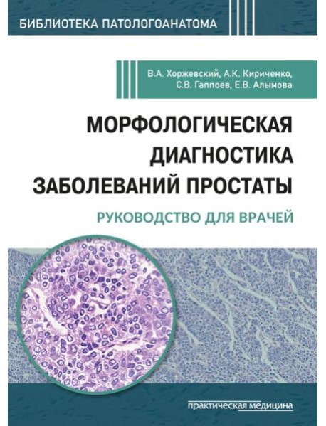 Морфологическая диагностика заболеваний простаты. Руководство для врачей