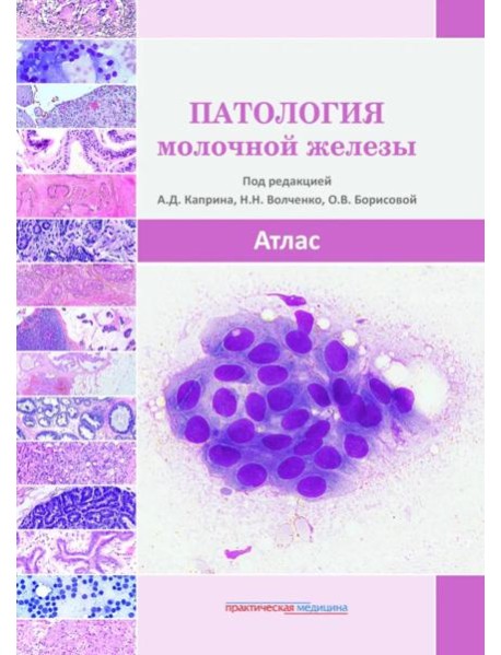 Патология молочной железы. Атлас