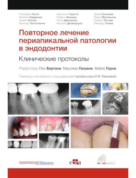 Повторное лечение периапикальной патологии в эндодонтии. Клинические протоколы