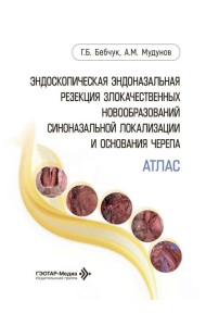 Эндоскопическая эндоназальная резекция злокачественных новообразований синоназальной локализации и основания черепа. Атлас