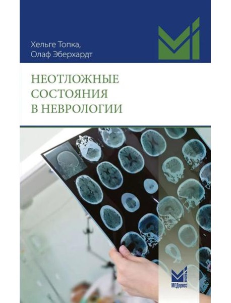 Неотложные состояния в неврологии. 2-е изд