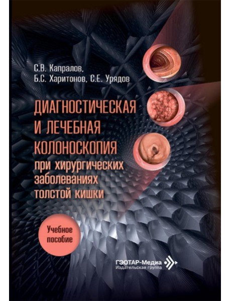 Диагностическая и лечебная колоноскопия при хирургических заболеваниях толстой кишки: Учебное пособие