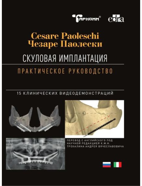 Скуловая имплантация. Практическое руководство - Чезаре Паолески