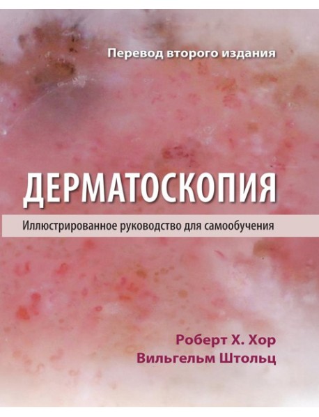 Дерматоскопия. Иллюстрированное руководство для самообучения