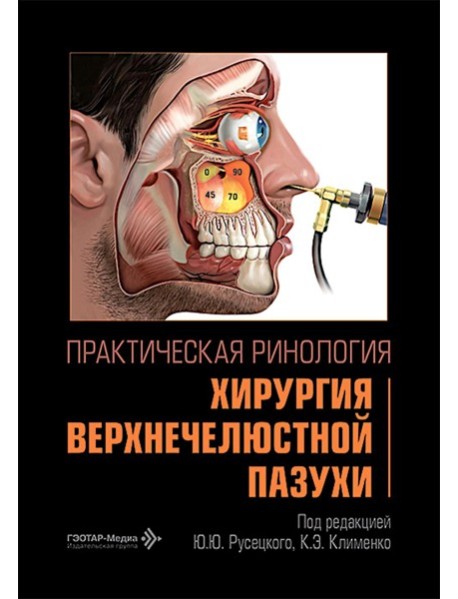 Практическая ринология: хирургия верхнечелюстной пазухи