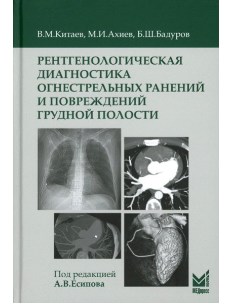 Рентгенологическая диагностика огнестрельных ранений и повреждений грудной полости. 2-е изд., перераб. и доп
