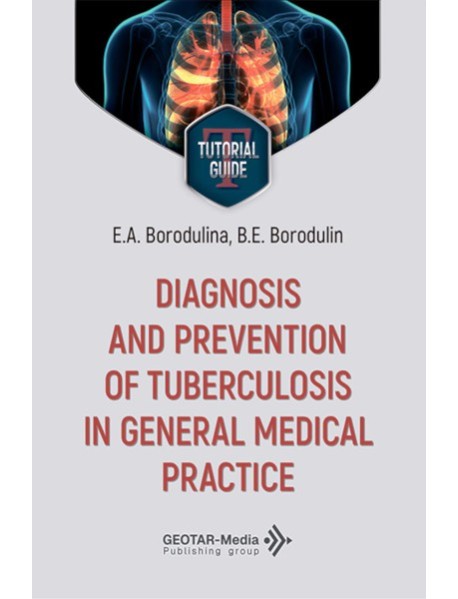 Diagnosis and prevention of tuberculosis in general medical practice = Диагностика и профилактика туберкулеза в общей врачебной практике