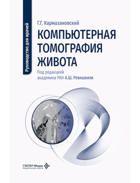 Компьютерная томография живота: руководство для врачей